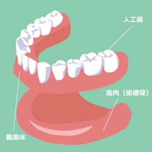 総入れ歯