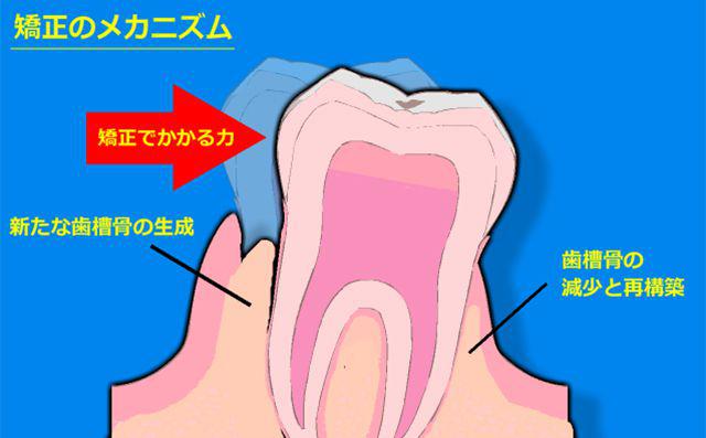 矯正のメカニズム