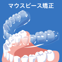 マウスピース矯正