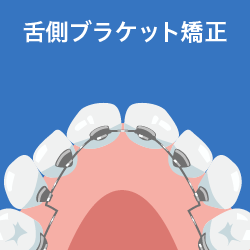 舌側ブラケット矯正