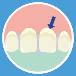 セルフチェック画像①