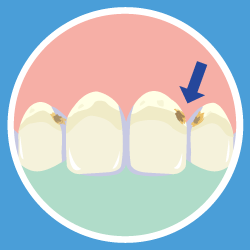 セルフチェック画像②