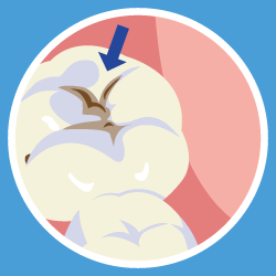 セルフチェック画像③