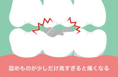 噛み合わせの不具合