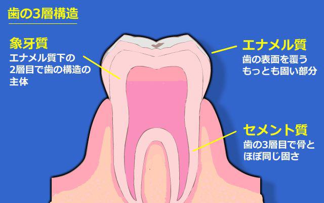 歯が欠ける・原因 歯が欠ける・原因