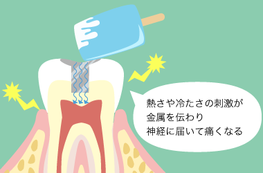しみる原因