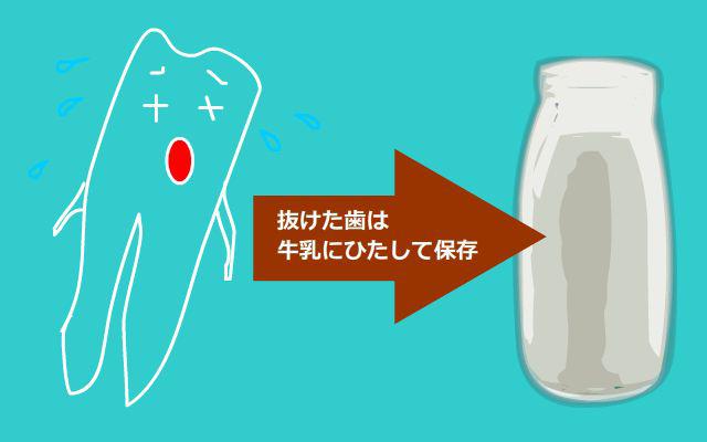 歯の保存方法 歯の保存方法